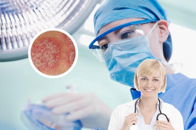 银屑病关节炎诊断-银屑病关节炎诊断依据