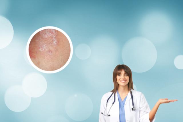 皮肤为什么会生癣-皮肤为什么会生癣的原因