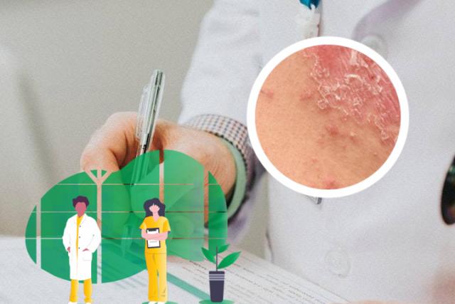 甘肃牛皮癣到哪里治疗