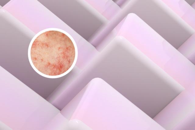金昌医院专业的治银屑病是哪家