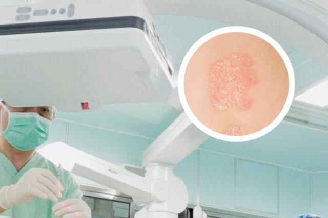 兰州银屑病医院：杨利兵医生-银屑病分为哪几种类型？