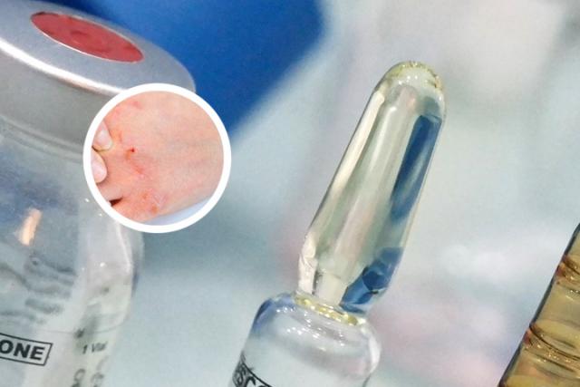 银屑病患者可以生孩子吗