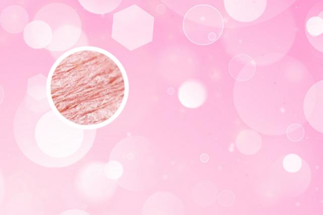 武威专业银屑病医院哪所可以治