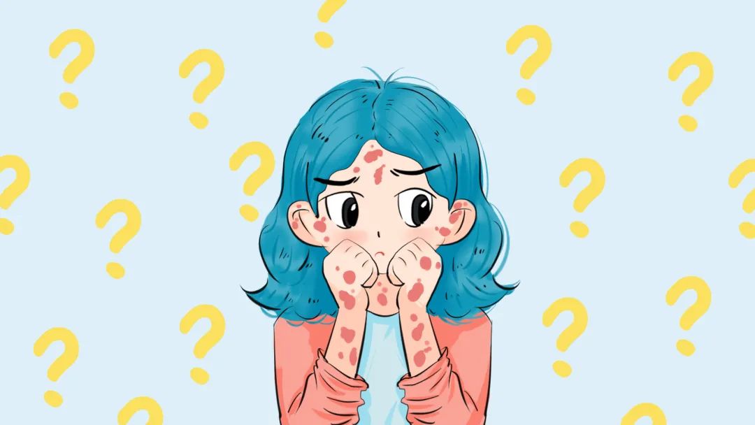 很多患者不知道：银屑病好转看季节？