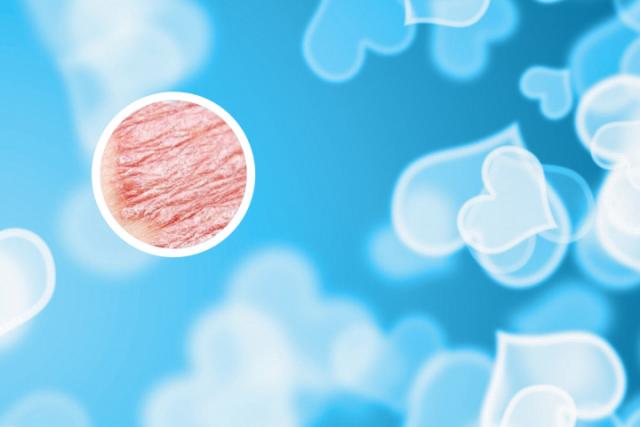 陇南银屑病哪家医院好