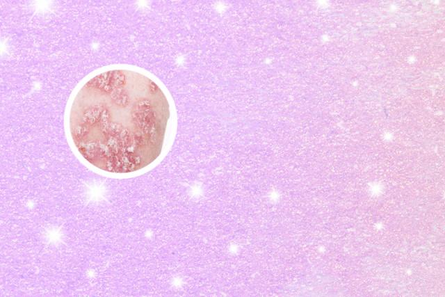 消银颗粒作用和效果