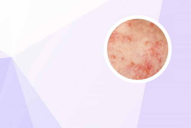 消银颗粒副作用大吗