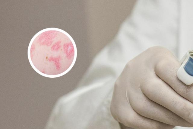 可善挺医院价格