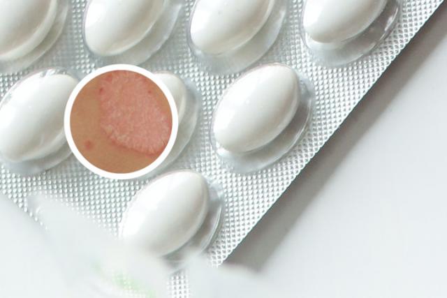 身上长癣用什么药膏好