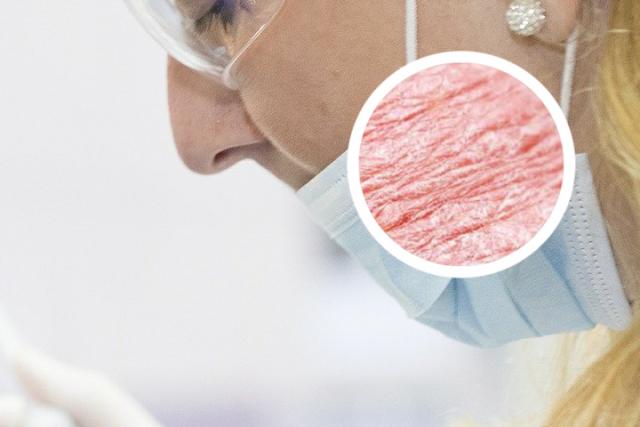 兰州什么医院治疗银屑病好