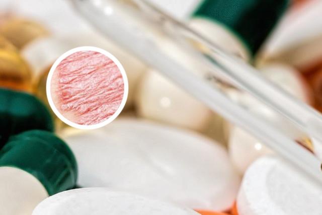 什么叫封包治疗银血病