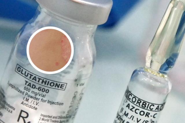 消银颗粒一般吃几个疗程