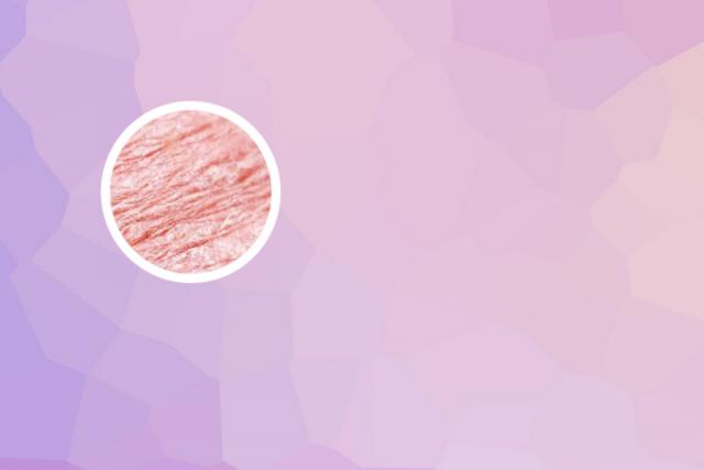 银屑病服用什么药最好