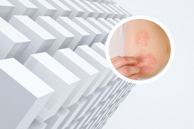 生物制剂多久打一次