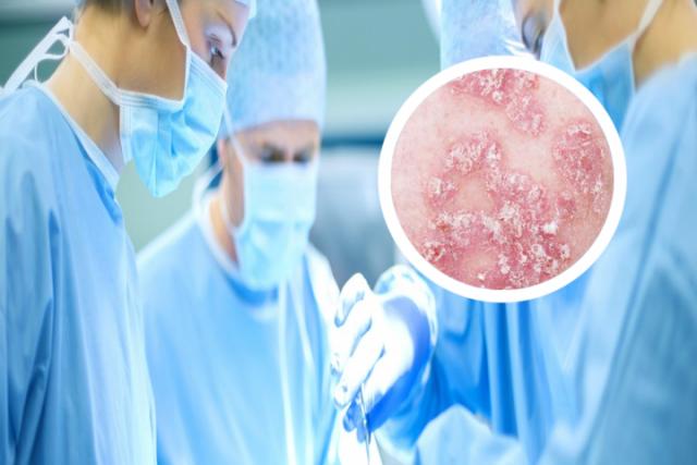 皮肤病为什么在海南好得快