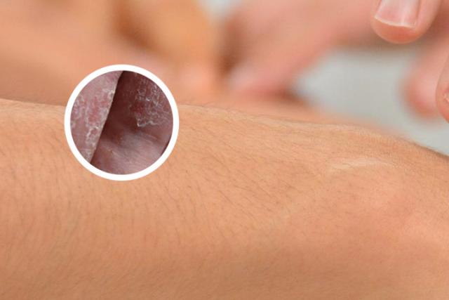 皮肤病图片大全详细的