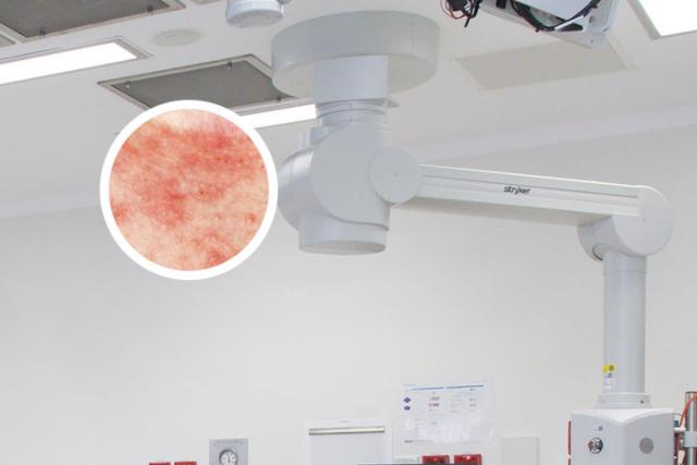 银屑病怎样才是痊愈