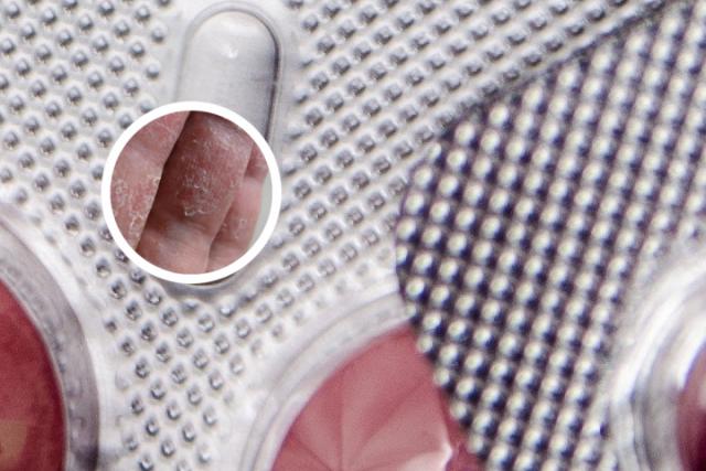 可善挺副作用大吗 影响生育吗