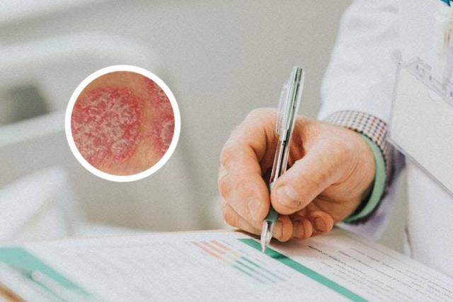 有坚持跑步把牛皮癣治好的吗