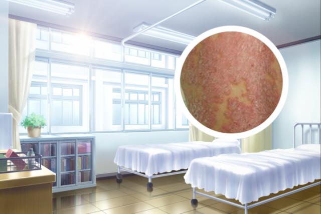 黑癣的症状图片