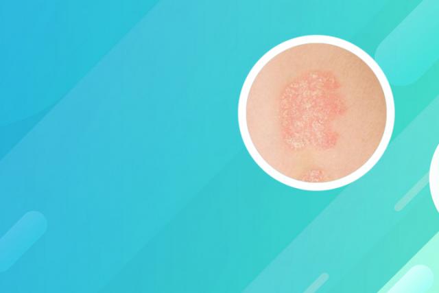 银屑病一开始是红色的点点吗