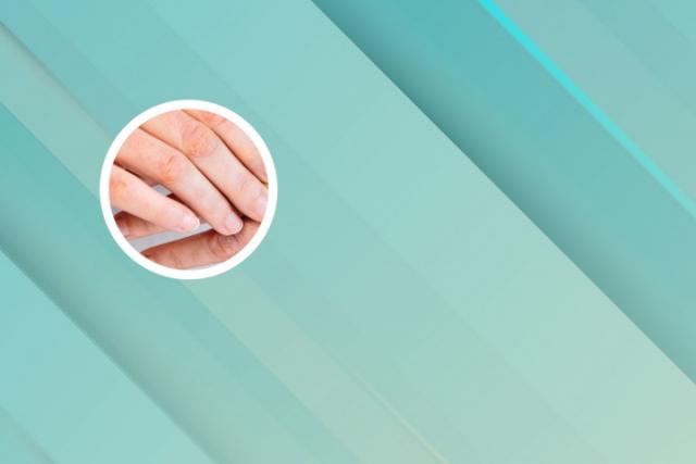 爷爷银屑病遗传孙子