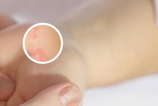 身上发干起皮怎么回事