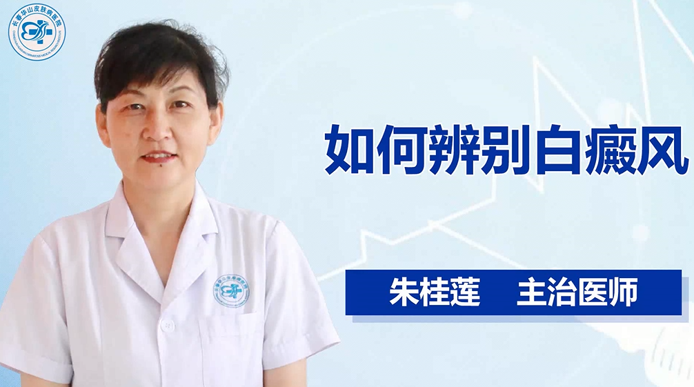 如何辨别白癜风
