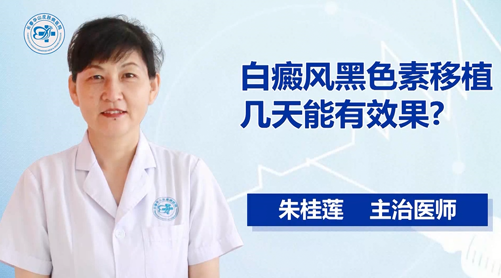 白癜风黑色素移植几天能有效果