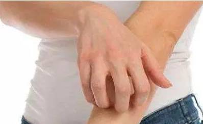 身上长白色的小点点是怎么回事