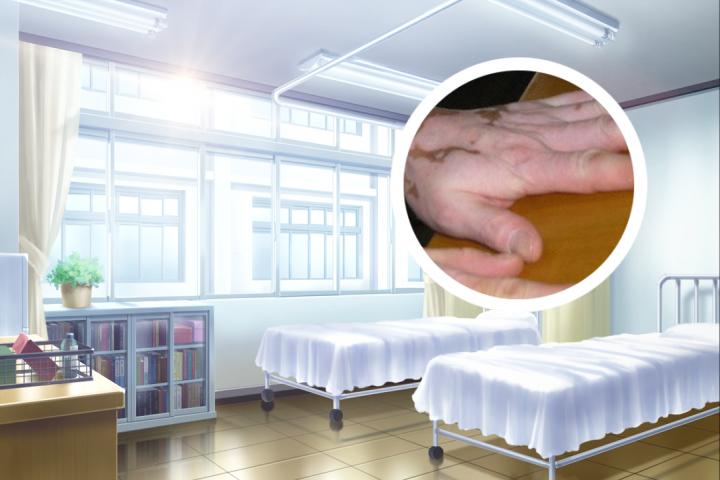 女性脸部白斑诱因